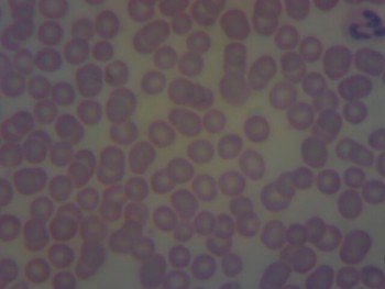 Микроскоп - 2015-05-26-094046.jpg