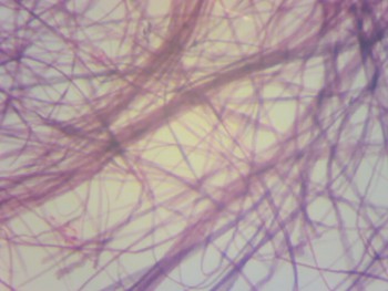 Гладкие мышцы