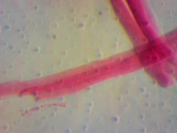 Поперечно полосатые мышцы