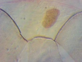 Деление яйцеклетки