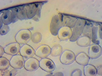 Митоз в корешке лука