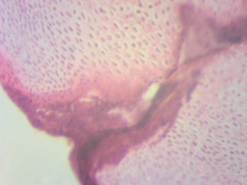 Микроскоп - 2015-11-28-203207.jpg